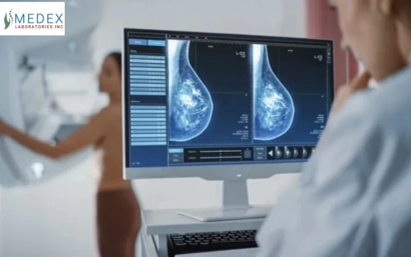 Understanding Breast Cancer Risk: Genetic and Diagnostic Testing Nationwide